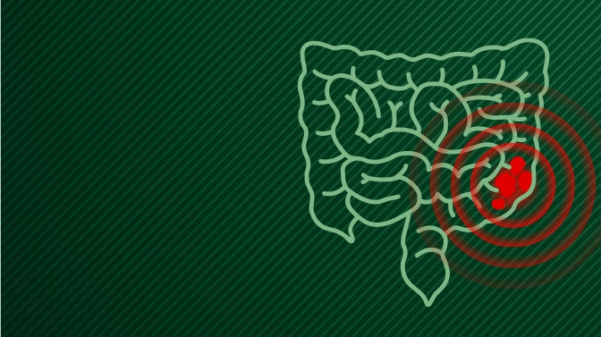 Setembro Verde conscientiza sobre o câncer de intestino