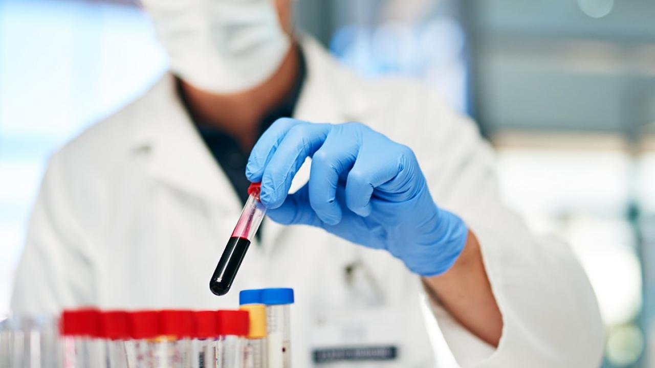 Um cientista usando luvas azuis e máscara segura um tubo de ensaio cheio de um líquido escuro, cercado por outros tubos de ensaio em um laboratório.