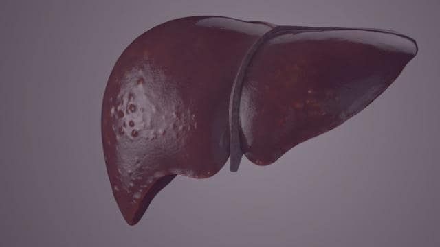 Uma renderização 3D de um fígado humano com uma superfície lisa e brilhante e algumas áreas texturizadas, sobre um fundo cinza.